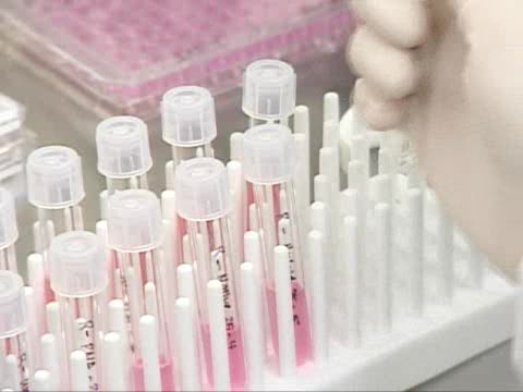 Распространение вируса H1N1 может начаться в Грузии в январе